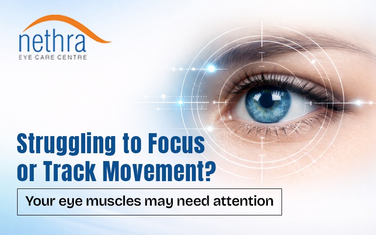 How Do Ocular Motility Disorders Impact Eye Movement and Vision?